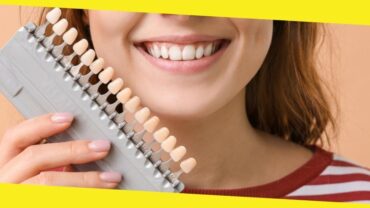 All You Need to Know Concerning Veneers