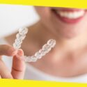 Benefits of Invisalign Treatments Over Traditional Braces