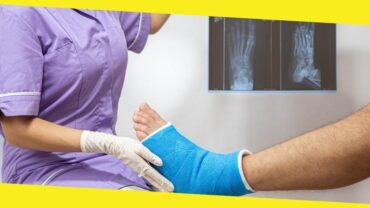 Top Myths About Bone Fractures