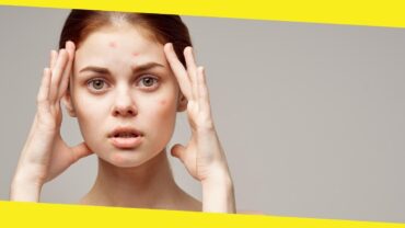 Learn About the Causes, Types, and Treatment Options Available for Acne
