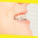 Types of Orthodontic Treatments You Need to Know About