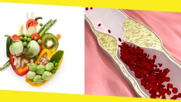 Best Foods to Keep You Safe From Clogged Arteries Naturally