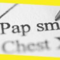 4 Pap Smear Top Advantages