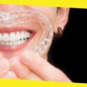 5 Favorite Tips on Handling Invisible Aligners