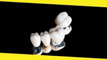 What You Ought to Know About Crowns and Bridges