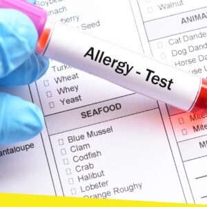 allergy testing