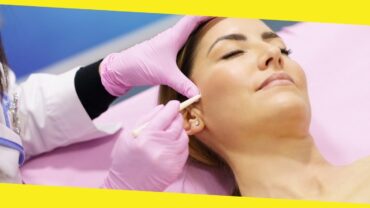 PDO Threads Lift: Benefits, Recovery, and Risks