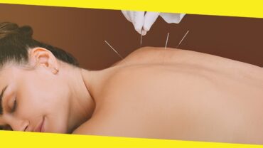6 Surprising Benefits of Acupuncture for Your Health