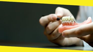 Missing a Tooth? How Does a Flipper Denture Work