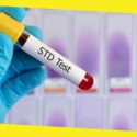 Everything You Should Know About Sexually Transmitted Diseases