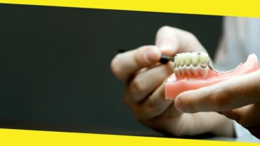 Advantages of Dentures