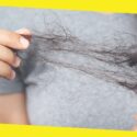 Common Causes of Hair Loss