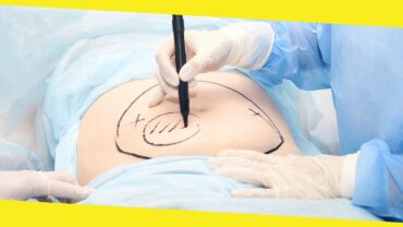 Everything You Should Know About Hysterectomy