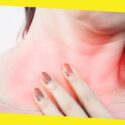 7 Tips For Reducing Acid Reflux Symptoms