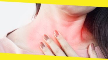 7 Tips For Reducing Acid Reflux Symptoms