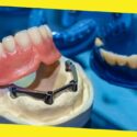 A Comprehensive Guide To Getting Your First Set of Dentures