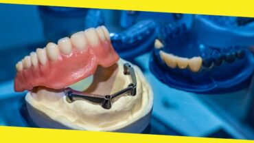 A Comprehensive Guide To Getting Your First Set of Dentures