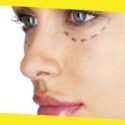 7 Benefits of Facial Implants