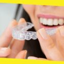 6 Signs Invisalign Is The Perfect Option For You