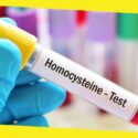 The Importance of Homocysteine Testing for Early Detection of Cardiovascular Diseases