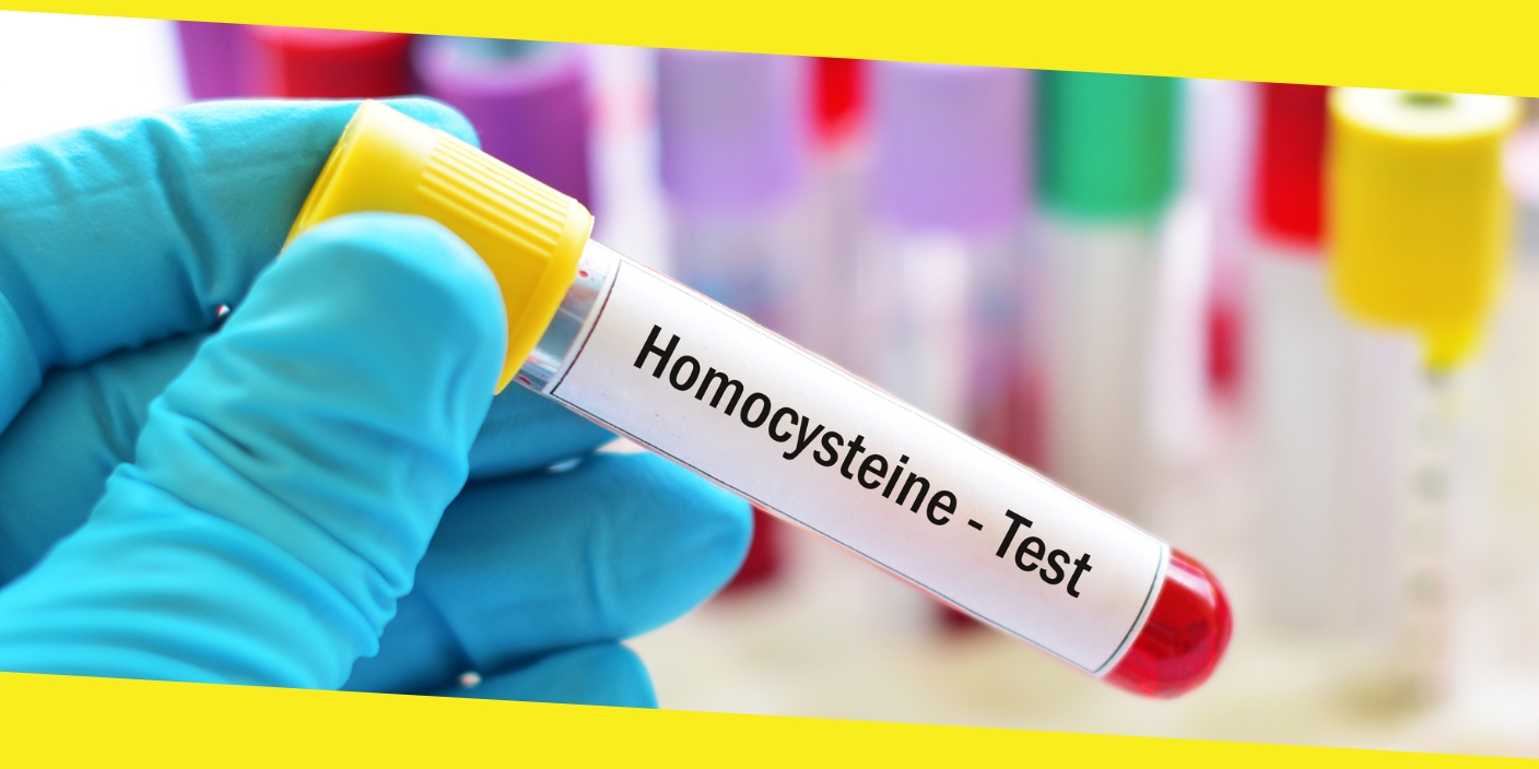 Homocysteine Testing for Early Detection of Cardiovascular Diseases