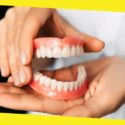 Everything You Must Know About Partial Dentures
