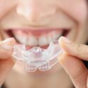 Unlocking Your Best Smile: Aesthetic Improvements for Your Teeth