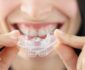 Unlocking Your Best Smile: Aesthetic Improvements for Your Teeth