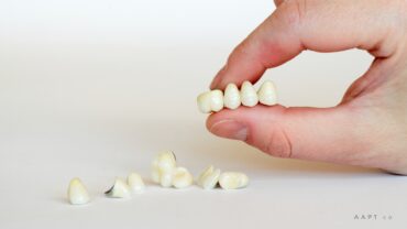 Bridging the Gap: All About Dental Crown Bridges