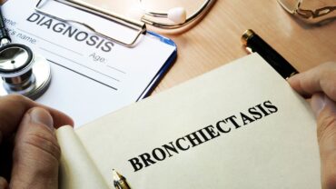 Can Bronchiectasis Worsen With Age? Insights for Seniors