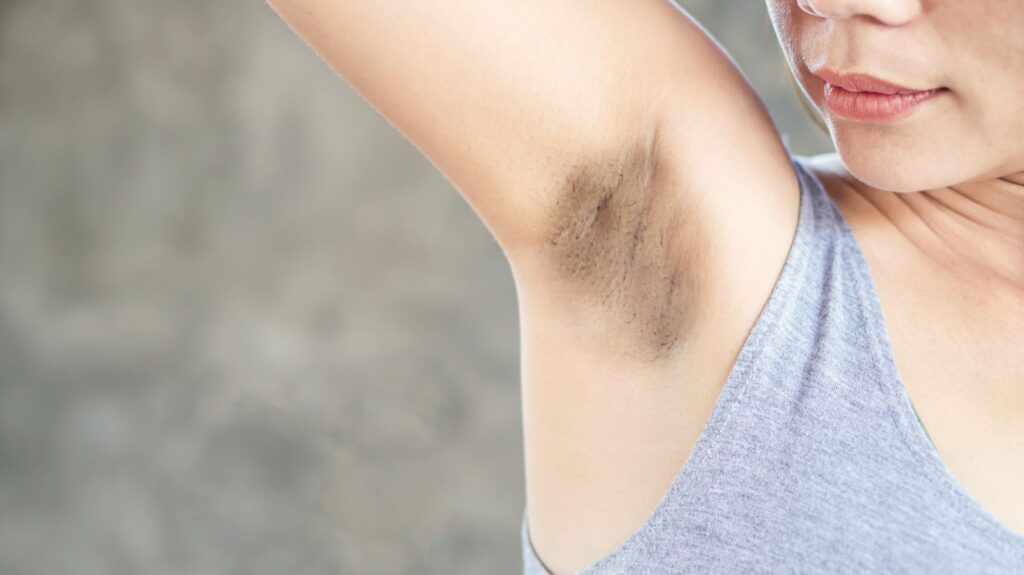 women with dark underarms