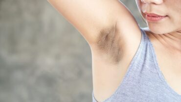 6 Best Home Remedies To Lighten Dark Underarms