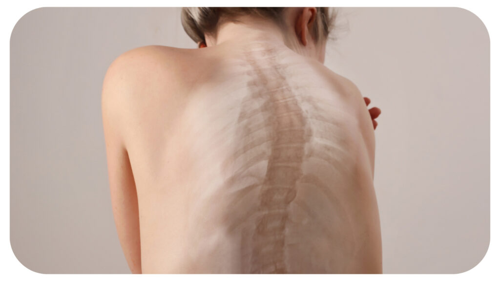 How is scoliosis diagnosed