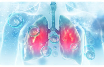 5 Diseases That Affect Your Lungs