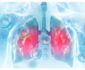 5 Diseases That Affect Your Lungs