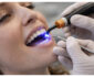 Enhancing Everyday Dental Care With Subtle Cosmetic Improvements