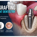 The Role Of Bone Grafting In Successful Implant Dentistry