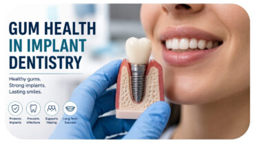 The Role Of Gum Health In Successful Implant Dentistry