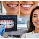 Why Preventive Dentistry Strengthens Outcomes For Smile Transformations