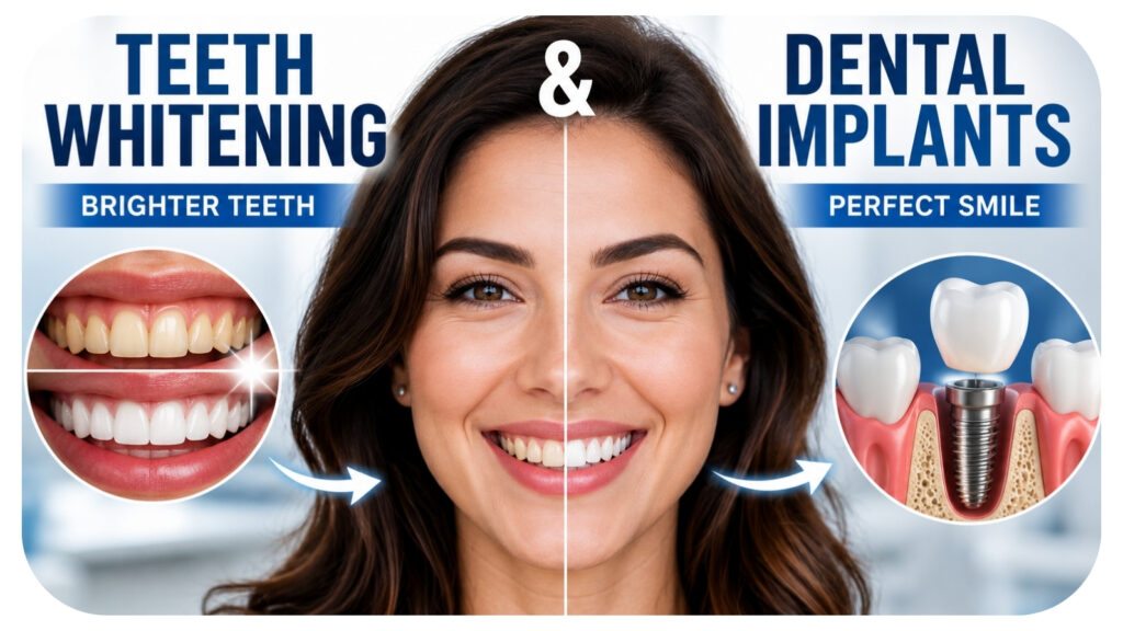 Before and after smile transformation showing teeth whitening and dental implant treatment, highlighting how teeth whitening complements dental implants by creating a brighter, more uniform, natural looking smile and enhancing overall dental aesthetics.